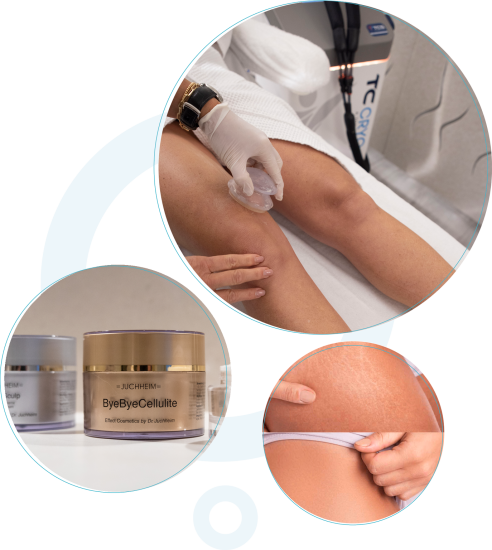 Min110_Noordwijk_anti_cellulite_behandeling Min110_Noordwijk_anti_cellulite_behandeling